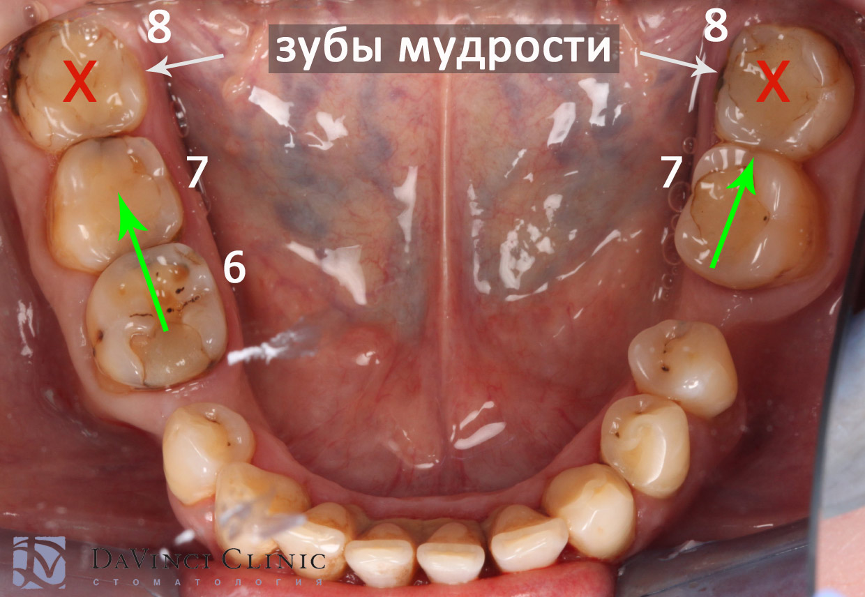 Цель ортодонтического лечения